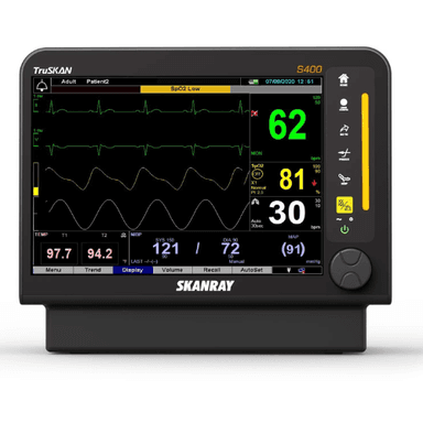 Monitoring